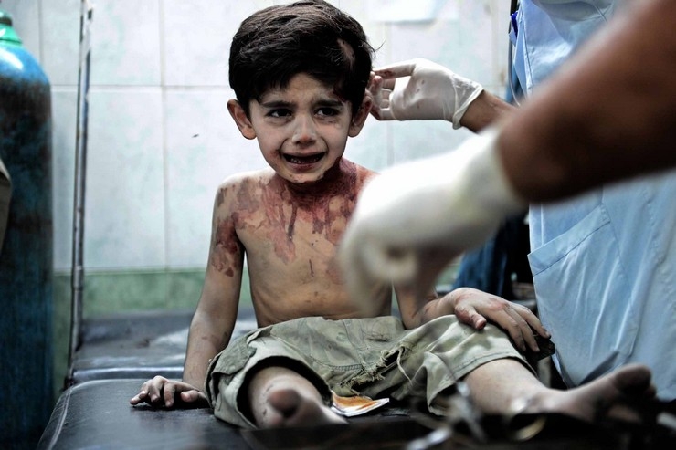 <p>Маленький мальчик-сириец, всего трех лет от роду, стал, как и многие другие сирийские дети, жертвой войны. </p>