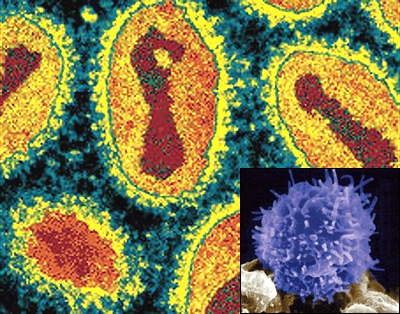 <p>Американские ученые обнаружили в Грузии «троюродного брата» вируса натуральной оспы</p>