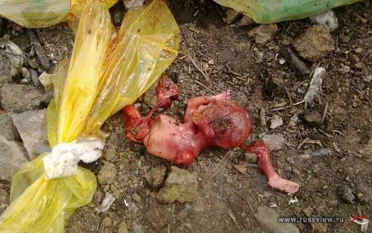 В России не прекращается массовое убийство нерождённых детей, которое нивелирует ценность человеческой жизни и делает человеческое тело товаром
